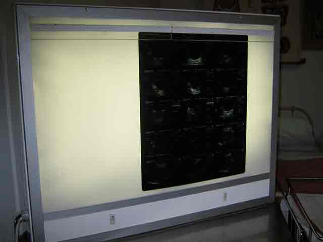 X-RAY LIGHTBOX, White Wall Mountable